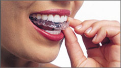 Invisalign